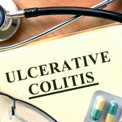 Risk Factors and Early Symptoms of Ulcerative Colitis