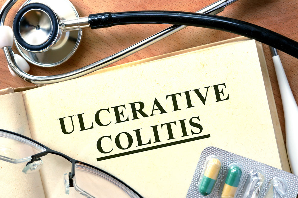 Risk Factors and Early Symptoms of Ulcerative Colitis
