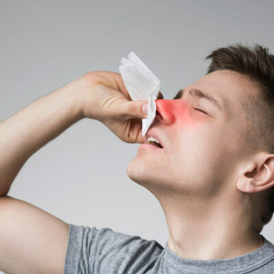 Risk Factors and Early Signs of Nasal Polyps