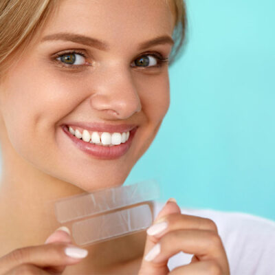 Teeth Whitening – Its Types, the Cost, and Complications
