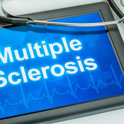 4 Treatment Options for MS