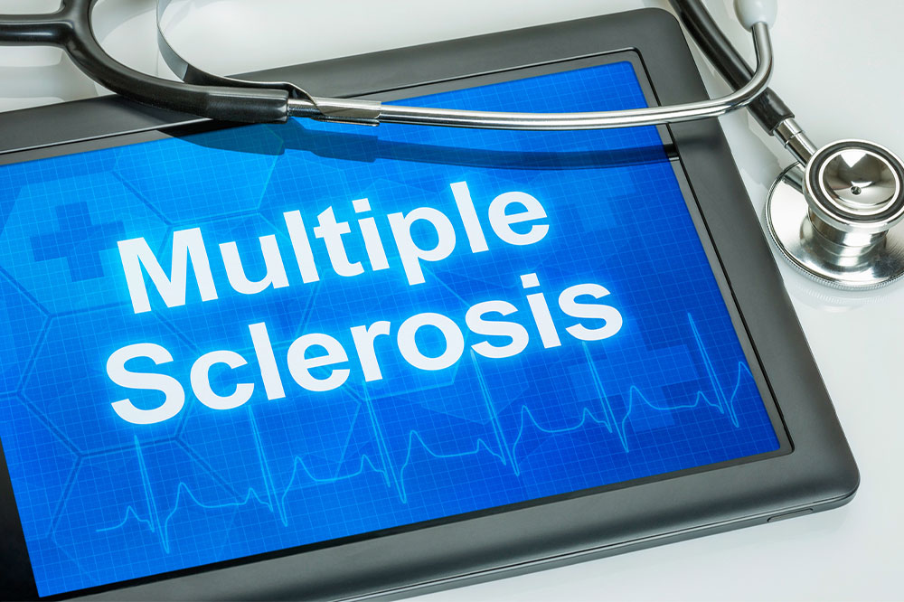 4 Treatment Options for MS